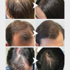 زيت البصل ساوفاسين لنمو الشعر - 100 مل