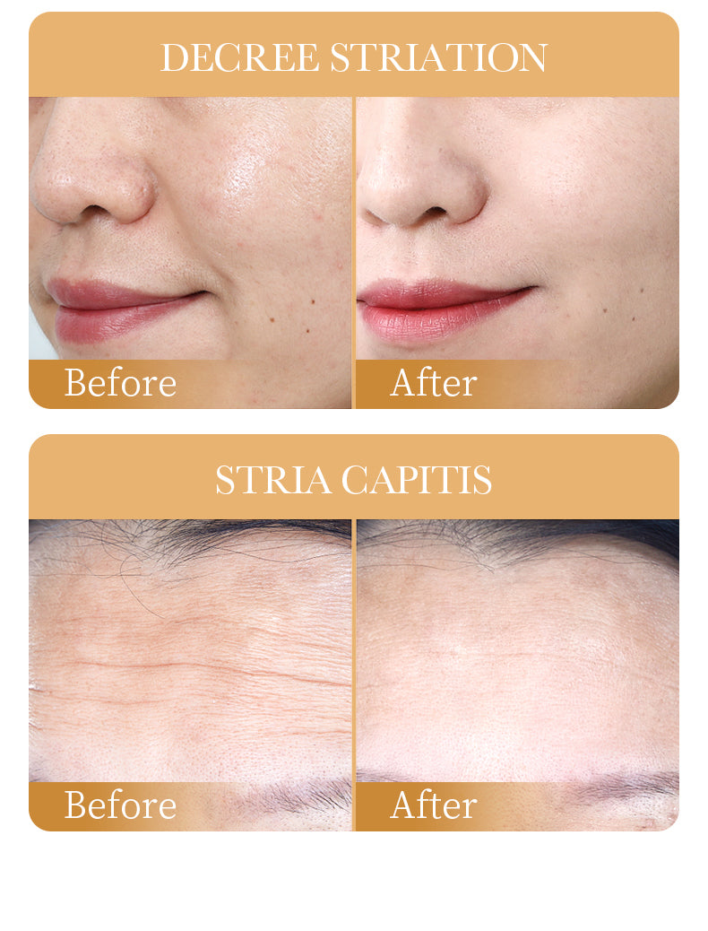 Sadoer Collagen Anti-Aging Mask - 25g Sadoer
