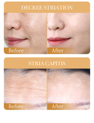 Sadoer Collagen Anti-Aging Mask - 25g Sadoer