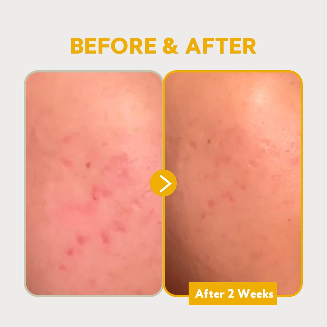 Tirtir Pure Vitamin C24 Serum - 30ml TIRTIR