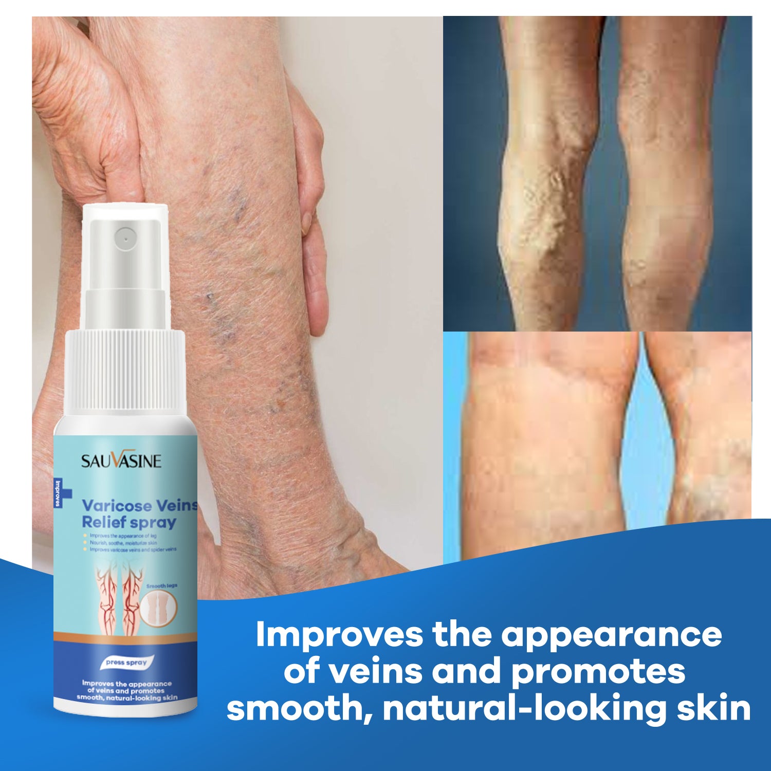 Sauvasine Varicose Veins Relief Spray - 30ml Sauvasine