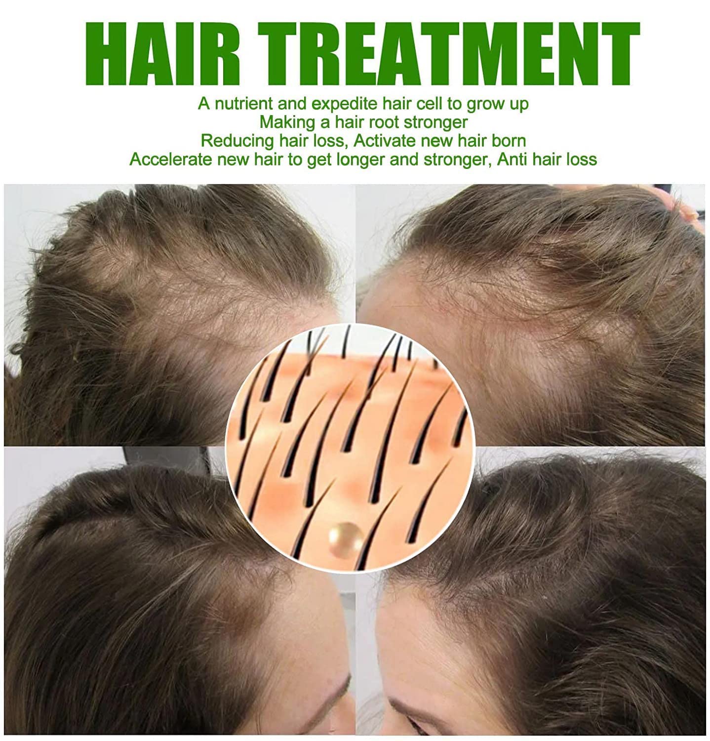Neo Hair Lotion - 120ml Neo