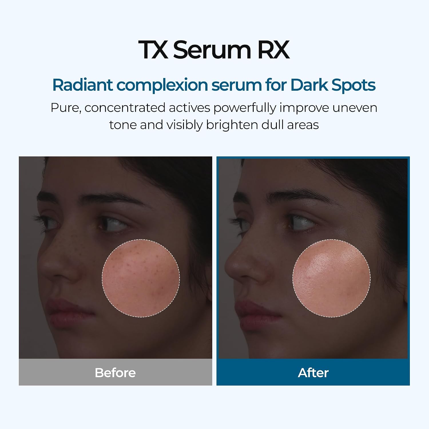 Dr. Melaxin Kojic Dark Spot Duo – Turmeric Toner Pads + TX Brightening Ampoule Dr. Melaxin