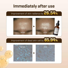 Some By Mi Galactomyces Pure Vit C Glow Serum - 30ml SOME BY MI