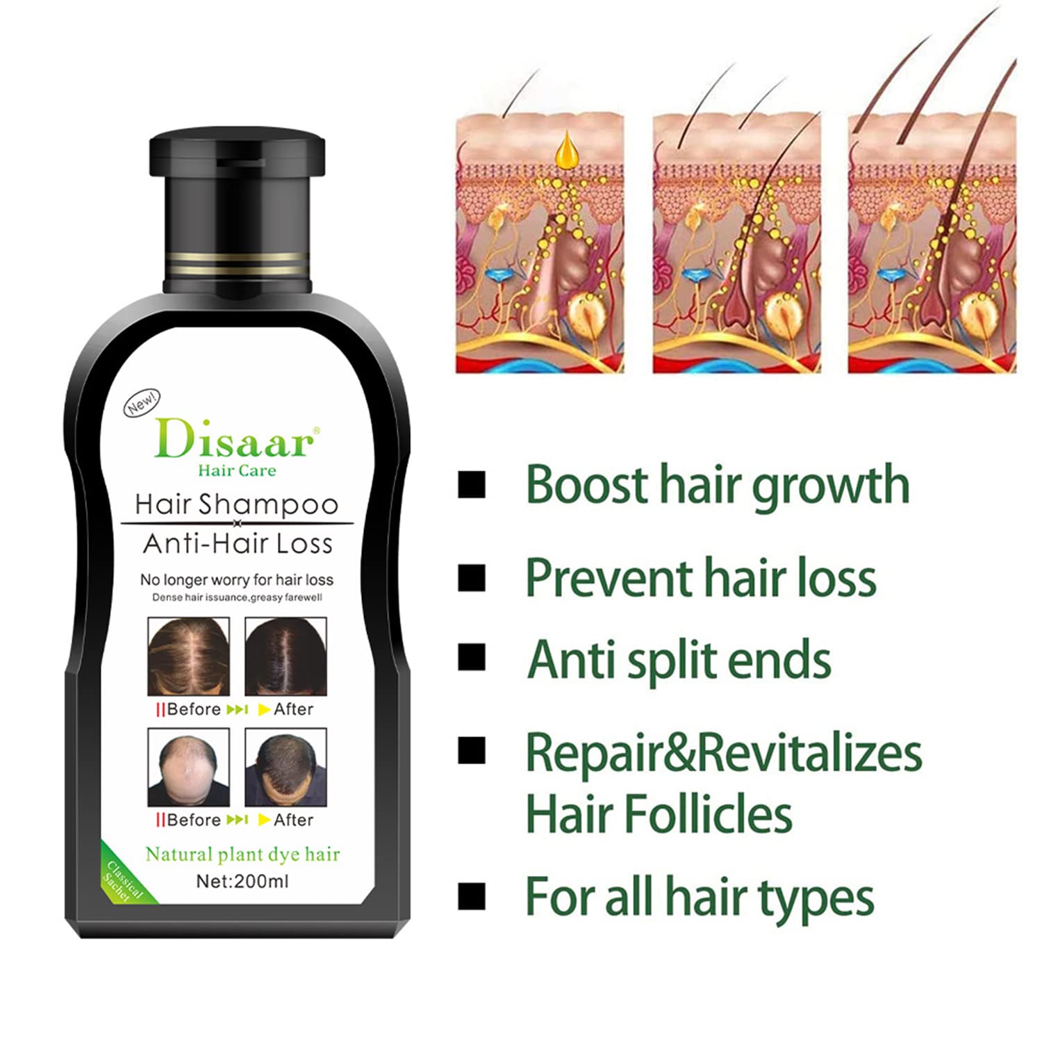 Disaar Hair Shampoo Anti-Hair Loss & Hair Growth - 200ml DISAAR