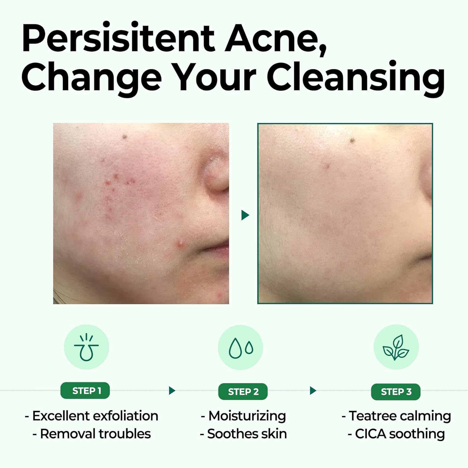 Some By Mi AHA.BHA.PHA 30 Days Miracle Cleansing Bar - 106g SOME BY MI