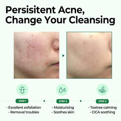 Some By Mi AHA.BHA.PHA 30 Days Miracle Cleansing Bar - 106g SOME BY MI