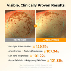 Dr. Melaxin Kojic Dark Spot Duo – Turmeric Toner Pads + TX Brightening Ampoule Dr. Melaxin