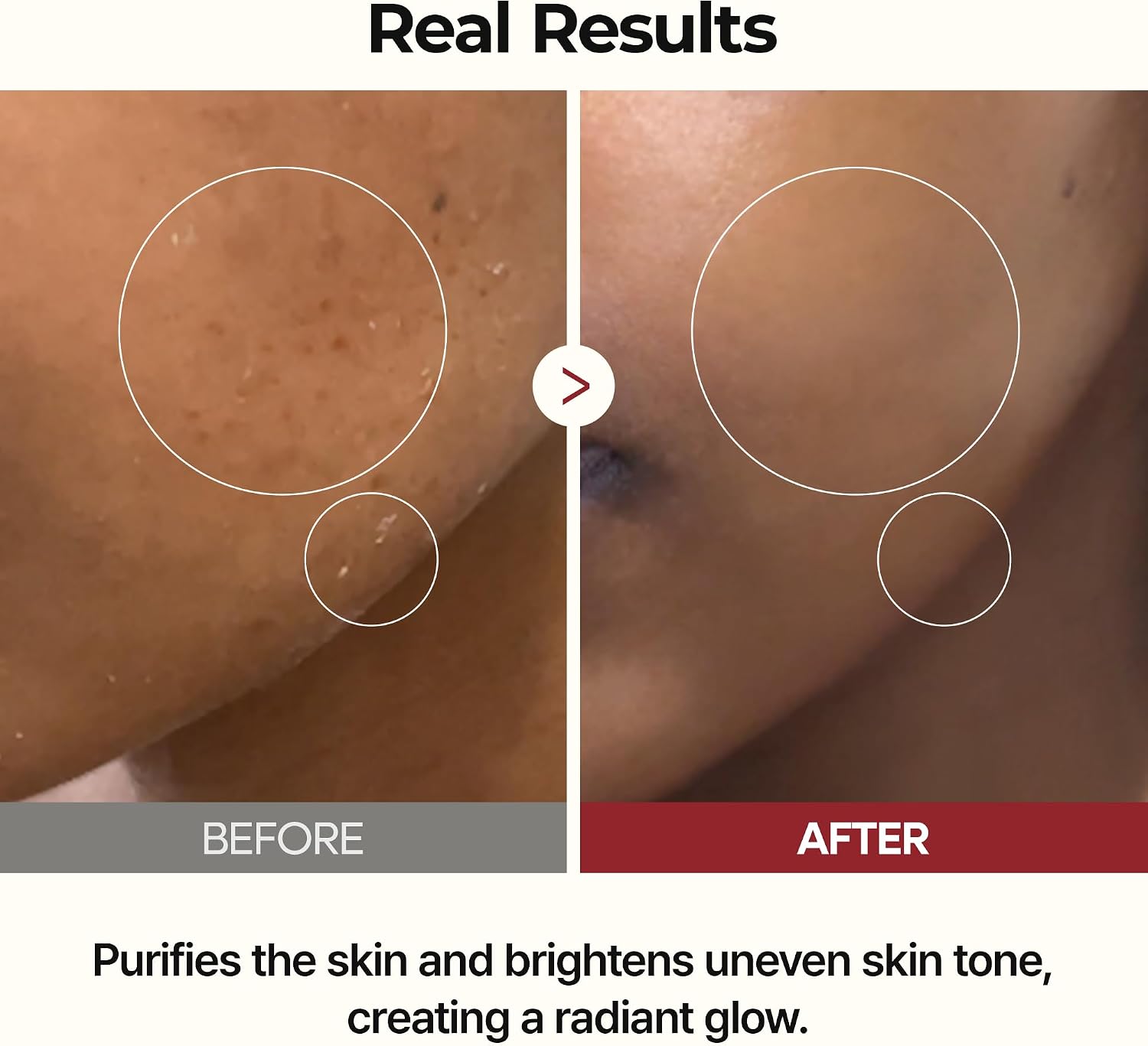 Dr. Melaxin Peel Shot White Rice Glow Duo – Brightening Toner + Serum Dr. Melaxin