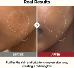Dr. Melaxin Peel Shot White Rice Glow Duo – Brightening Toner + Serum Dr. Melaxin