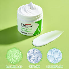 Disaar SA Anti-Acne Facial Cream - 120g Disaar