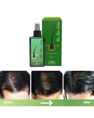 Neo Hair Lotion - 120ml Neo