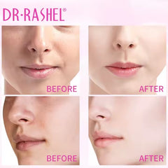 Dr.Rashel white Fade spot Toner - 100ml DR.RASHEL