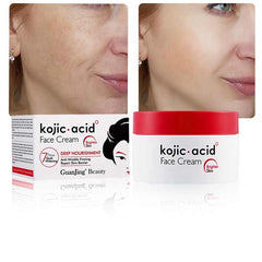 Guanjing Kojic Acid Face Cream Deep Nourishment - 50g GuanJing Beauty
