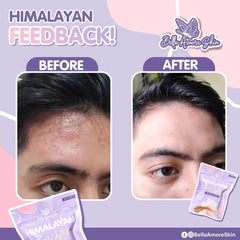 Bella Amore Himalayan Healing Soap Bella Amore Skin