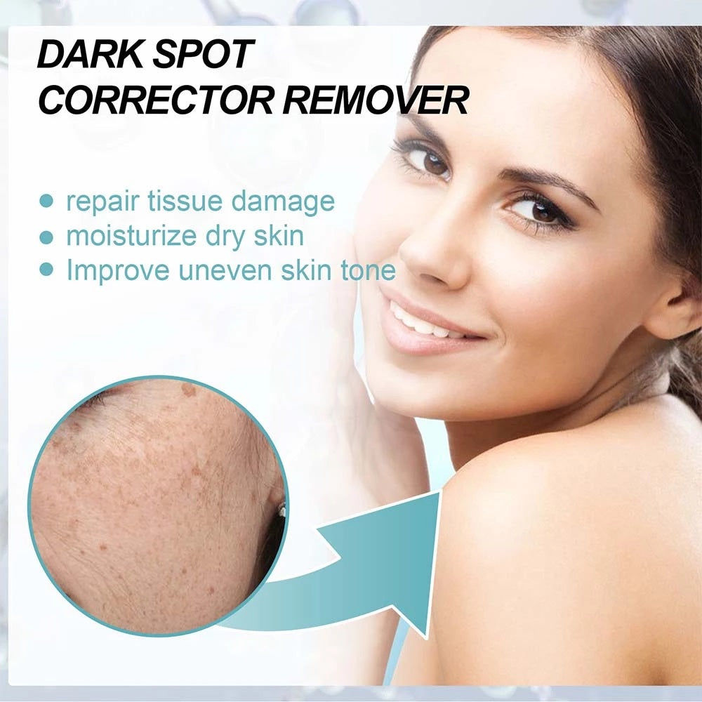 Lanthome Dark Spot Corrector Remover - 30g LANTHOME