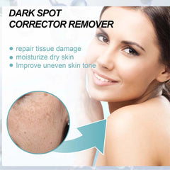 Lanthome Dark Spot Corrector Remover - 30g LANTHOME