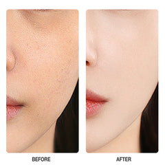 Skinever Vitamin C Brightening Toner - 100ml Skinever
