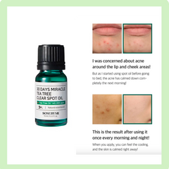 Some By Mi 30Days Miracle Tea Tree Clear Spot Oil -10ML SOME BY MI