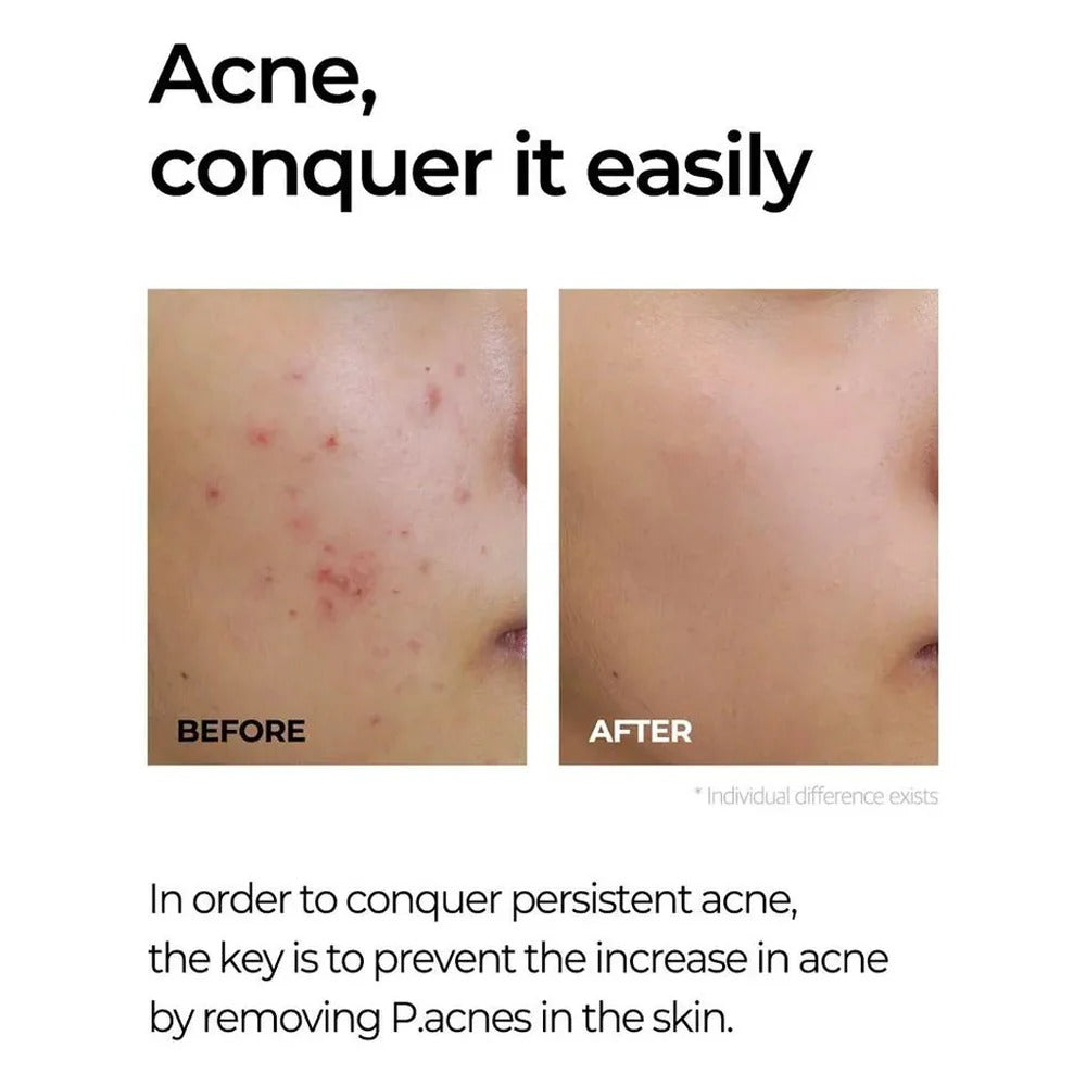 Some By Mi MIRACLE AC CLEAR SPOT TREATMENT - 10g SOME BY MI