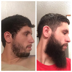 Prorgano 2 IN 1 Beard Growth Kit - Growth Activator + Derma Roller PRORGANO