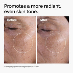 The Ordinary Glycolic Acid 7% Exfoliating Toner