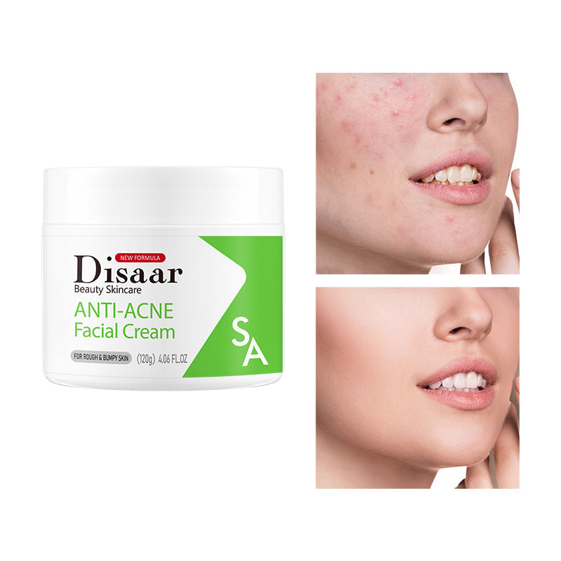Disaar SA Anti-Acne Facial Cream - 120g Disaar
