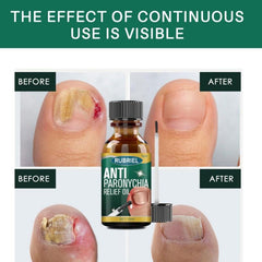 Rubriel Anti Paronychia Relief Oil - 10ml RUBRIEL