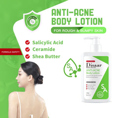 Disaar SA Anti-Acne Body Lotion - 300g Disaar