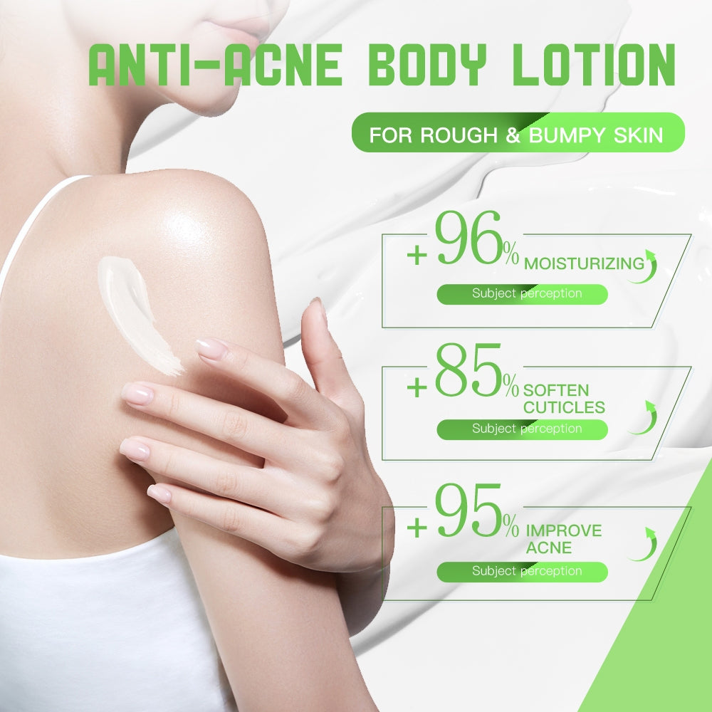 Disaar SA Anti-Acne Body Lotion - 300g Disaar