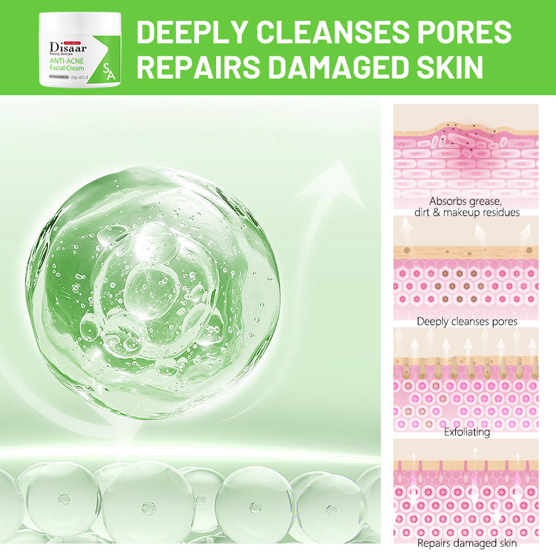 Disaar SA Anti-Acne Facial Cream - 120g Disaar