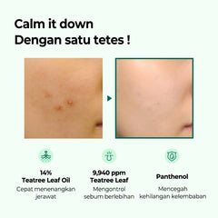 Some By Mi 30Days Miracle Tea Tree Clear Spot Oil -10ML SOME BY MI