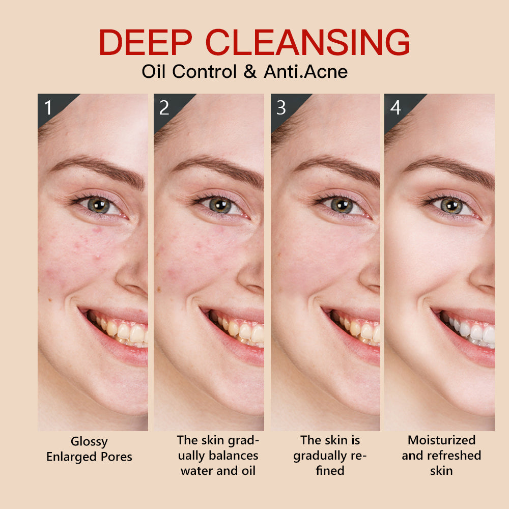 Guanjing Kojic Acid Facial Wash - 100g GuanJing Beauty