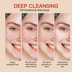 Guanjing Kojic Acid Facial Wash - 100g GuanJing Beauty