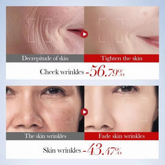 SADOER Snail Collagen Skincare Set - Anti-Wrinkle & Firming 5-Piece Kit Sadoer