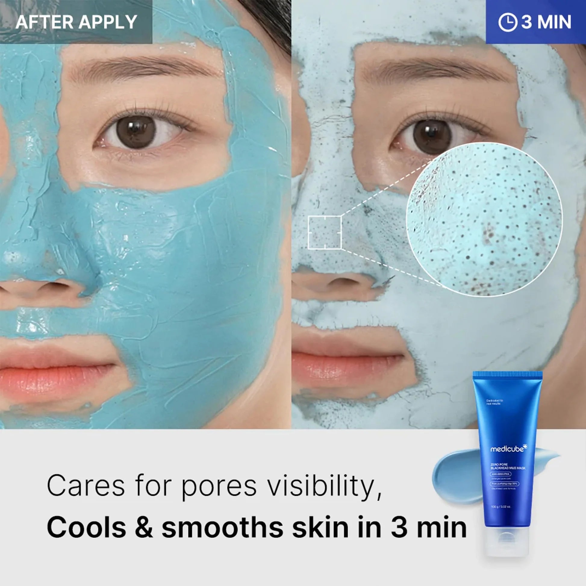 Medicube Zero Pore Blackhead Mud Mask 100 g Medicube