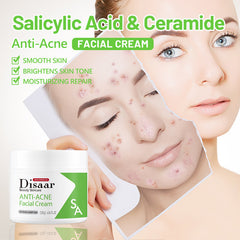 Disaar SA Anti-Acne Facial Cream - 120g Disaar