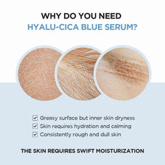 SKIN1004 Madagascar Centella Hyalu-Cica Blue Serum - 50ml SKIN1004