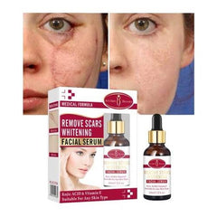 Aichun Beauty Remove Scars Whitening Facial Serum Kojic Acid & Vitamin E - 30ml Aichun Beauty