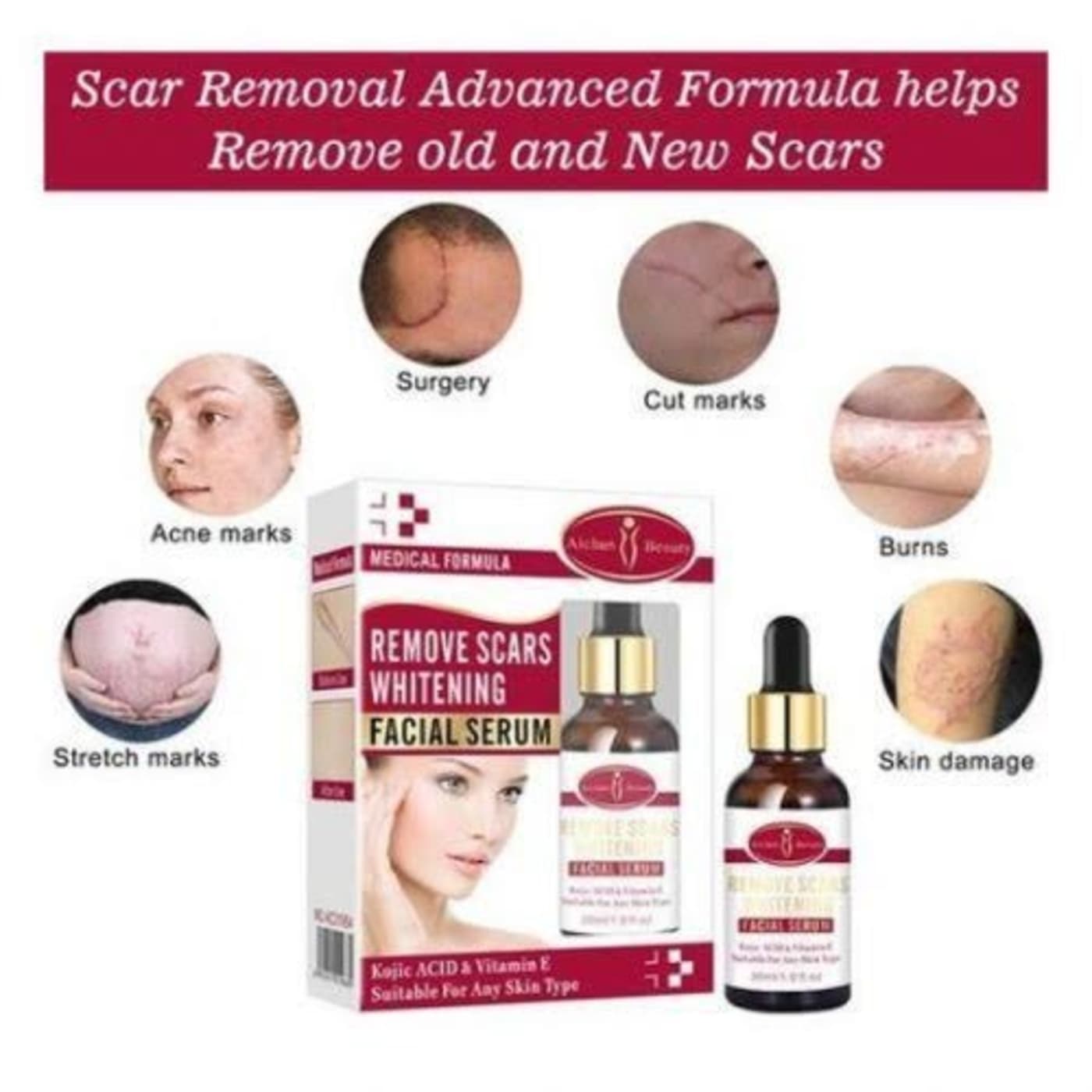 Aichun Beauty Remove Scars Whitening Facial Serum Kojic Acid & Vitamin E - 30ml Aichun Beauty