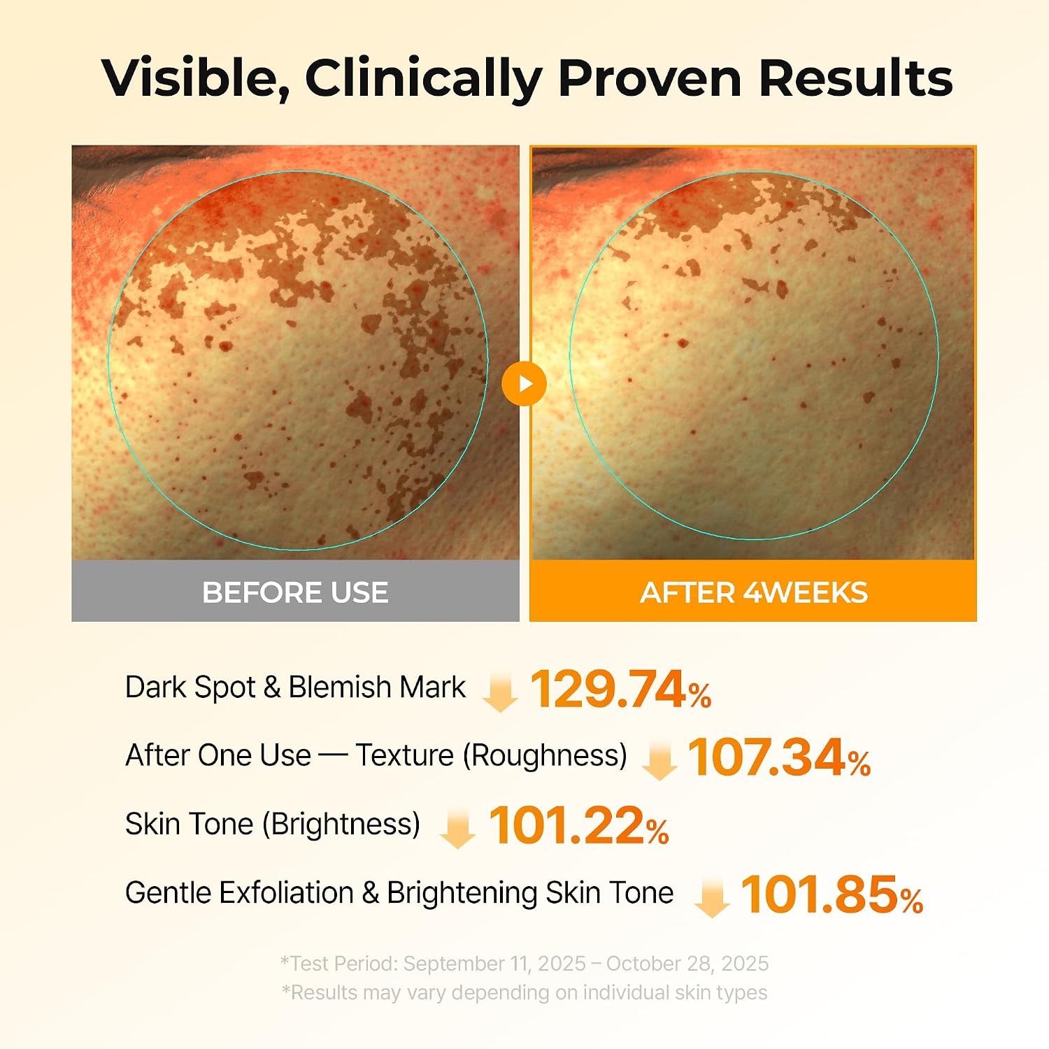 Dr. Melaxin Kojic Dark Spot Duo – Turmeric Toner Pads + TX Brightening Ampoule Dr. Melaxin