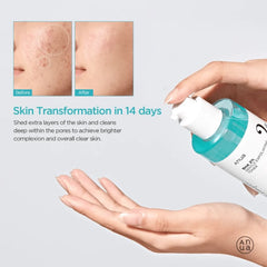 ANUA BHA 2 Gentle Exfoliating Toner 150ml Anua