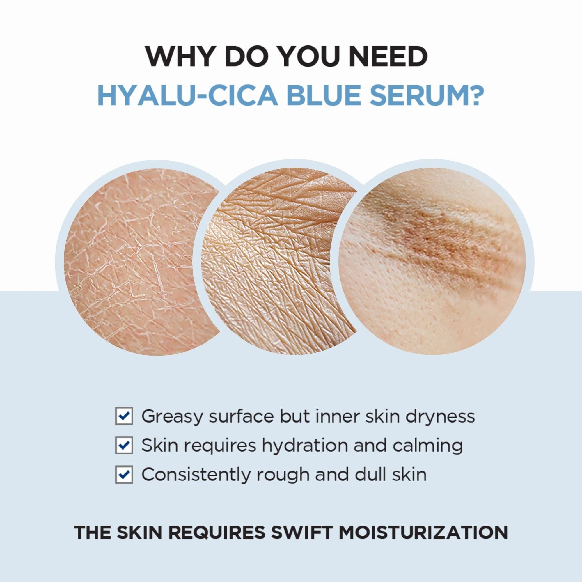 SKIN1004 Madagascar Centella Hyalu-Cica Blue Serum - 50ml SKIN1004